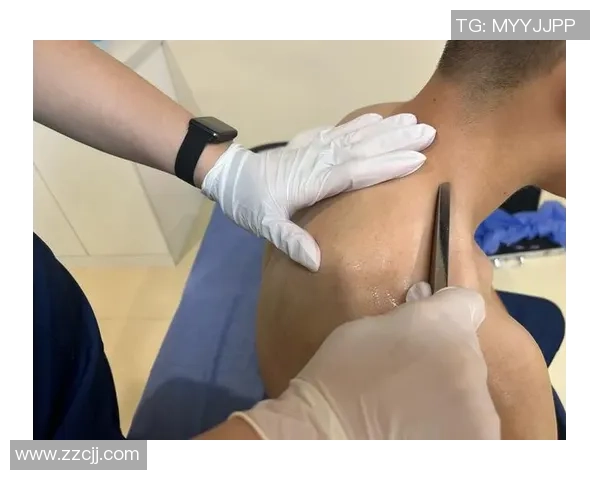 足球球星筋膜刀助力运动恢复探索科学训练与健康新趋势